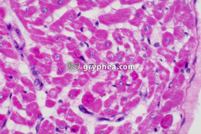 Fibres musculaires cardiaques CT x200 - gryphea.com